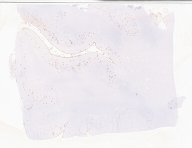 ['deident_4f9d4430-6786-48fd-85ce-240288f71bf3_69b05271.jpg']