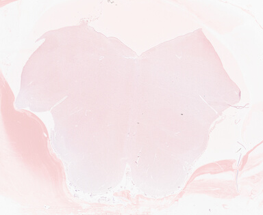['deident_8da1a985-42c0-4f84-a47f-0c0e64d8d105_69b0528e.jpg']