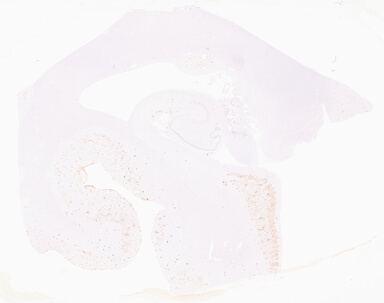 ['deident_e5ffe8cc-bdf1-468d-a4f7-a9ebe277da80_69b052b6.jpg']