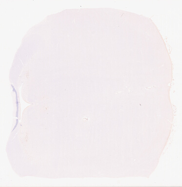 ['deident_a6b5418d-1552-468c-aaa1-930f52845cbe_69d945b1.jpg']