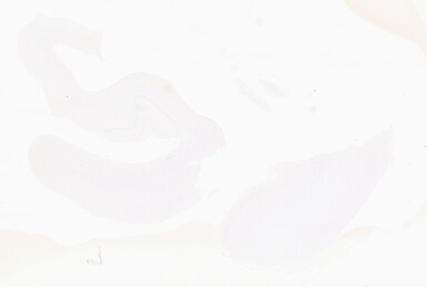 ['deident_9c63e311-fb2f-4358-b788-e7875491624f_69d945aa.jpg']
