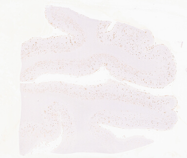 ['deident_cb905b98-16e2-4110-88bc-ade97b986f8e_69d945bd.jpg']