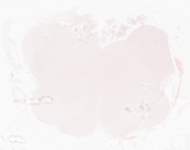['deident_797bb04b-a959-4568-9326-9a19f5841827_69d94592.jpg']