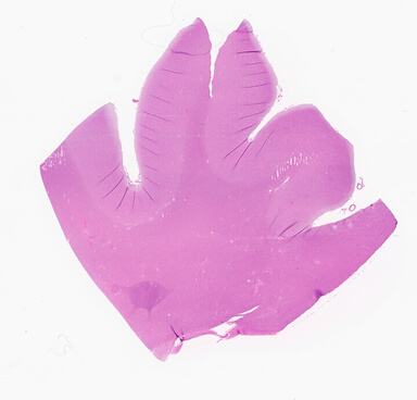 ['deident_f35fe18d-b7c8-4a0b-9c13-7cc6858b61fd_69d945da.jpg']