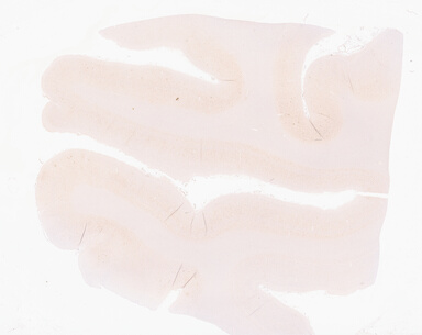 ['deident_92d86173-a218-4ecf-a355-15290be089c3_69d9459b.jpg']
