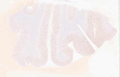 ['deident_682acdb7-7b11-4237-aced-84d6df8a3fda_69d9458a.jpg']