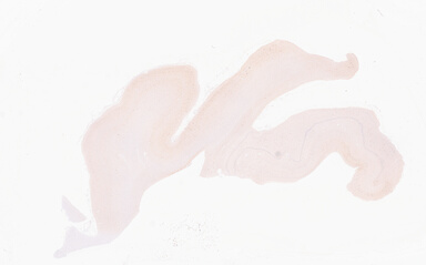 ['deident_d1eac647-c597-4287-af7e-9e7156488b65_69d945c3.jpg']