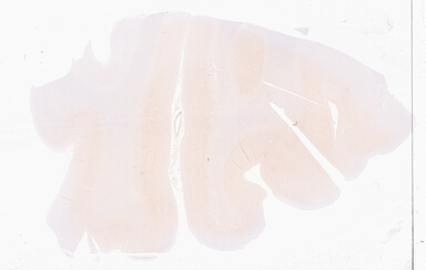 ['deident_5b3ee0e9-2042-42ab-b45b-edde98f0cd38_69d9457f.jpg']