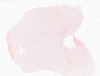 ['deident_60ae9075-f267-4b18-8ca9-0607d0647a84_69d94581.jpg']