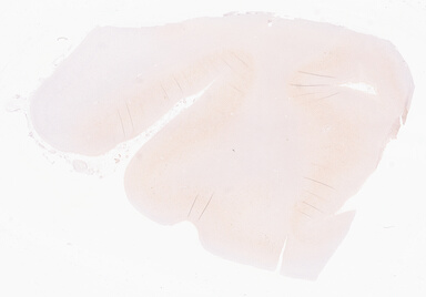 ['deident_f3717b41-8536-4484-b1fe-537b45c79606_69d945dc.jpg']