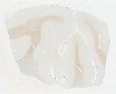 ['deident_c706ba35-1a43-49ab-b0ac-5c11c97d27aa_69b0305a.jpg']