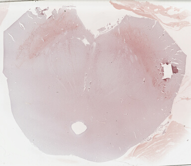 ['deident_c46acdaa-1058-4555-a698-40637e9be63b_69b03059.jpg']