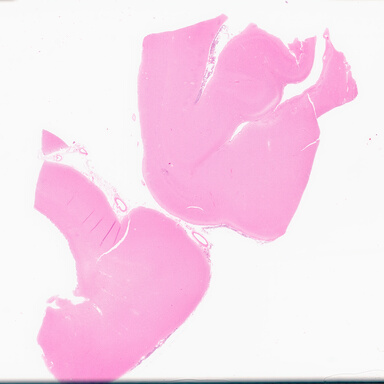 ['deident_0f12a993-c855-4895-9ee7-6fb027414273_69b03025.jpg']