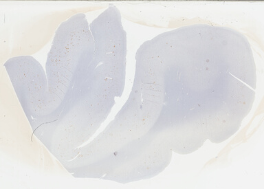 ['deident_fa88826c-822b-49bf-a1f2-763d2cfe220e_69b03061.jpg']