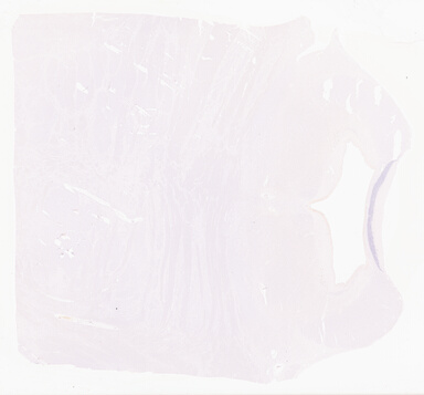 ['deident_6555f7db-8e90-44bd-a182-a18bac875dad_69b0303b.jpg']