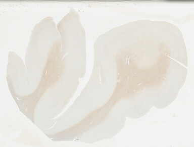 ['deident_679bc848-5db3-40e5-b950-e67bee379ccb_69b0303c.jpg']