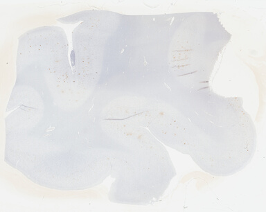 ['deident_bca42f5e-9eb3-4f17-9f16-806288613634_69b03054.jpg']