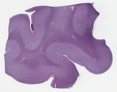['deident_e82f2666-cb14-4036-a8a7-c996d535c6d6_69b0305f.jpg']
