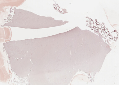 ['deident_e188ca6a-0884-4c98-859f-a89a98ad2b2d_69b03a84.jpg']