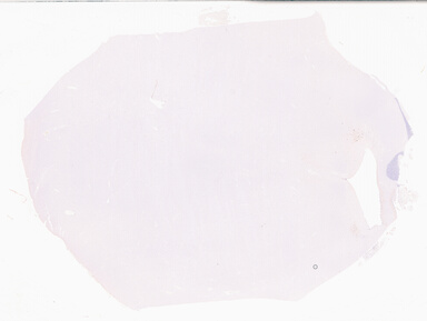 ['deident_847ad9cf-e467-4853-92c5-69be93af5c82_69b03a61.jpg']