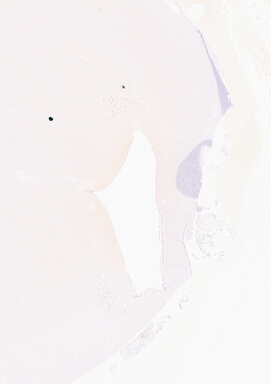 ['deident_ade537c6-4795-4165-ae25-fb95701e4a18_69b03a69.jpg']