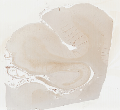 ['deident_1739dc91-67be-442f-b784-57fb976f01fa_69b03a2c.jpg']