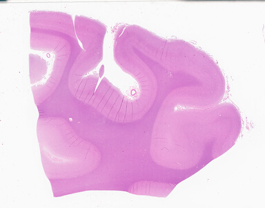 ['deident_e56527d7-0833-478a-948a-d8e4cbd3cfbb_69b061ab.jpg']