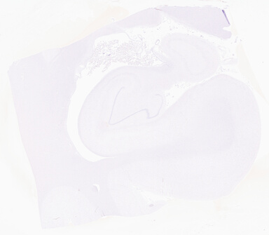 ['deident_e91a20e1-722f-45cd-9ecf-e9a9ff56c577_69b061b3.jpg']