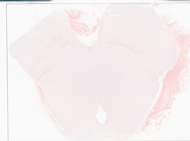 ['deident_4766e5d2-ae4d-4f3f-a968-52f78b45dfa5_69b06176.jpg']