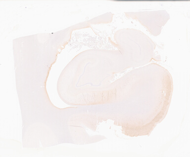 ['deident_87b4a13e-7e9b-4f58-becc-106f4acc4867_69b06191.jpg']