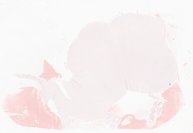 ['deident_735f0a92-c0d5-422d-82d2-3f4811f698db_69b06187.jpg']