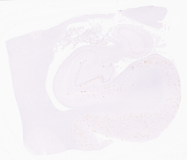 ['deident_05c6517f-8e42-49e7-8d44-8ff9b8c22a07_69b0614f.jpg']