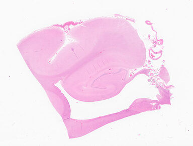 ['deident_e5b912f9-f472-4b49-97fd-c35c7ca13058_69d94f7a.jpg']