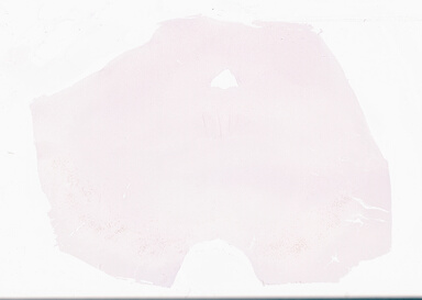 ['deident_60dc0d6c-b6da-4fa3-9350-8d6851829edd_69d94f27.jpg']