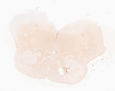 ['deident_b29452fa-1a09-4342-8941-781ff6eb3e61_69d94f62.jpg']