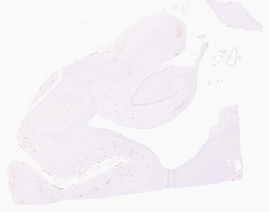 ['deident_060bbad6-4867-4eae-8166-0f34d3e12b7a_69d94f00.jpg']