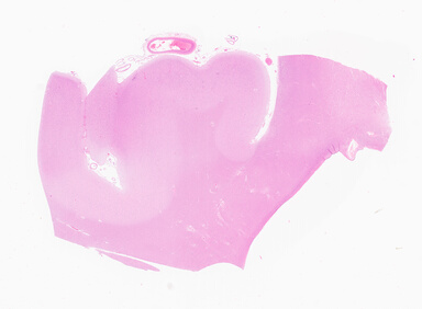['deident_071fe232-b1af-449d-8c12-9d9cecae568d_69d94f04.jpg']