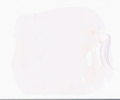 ['deident_65153c21-a793-49cb-8038-079c6b3ce83d_69d94f2e.jpg']