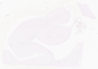 ['deident_28ceef86-32b1-49d5-b8e5-e56211614053_69d94f10.jpg']