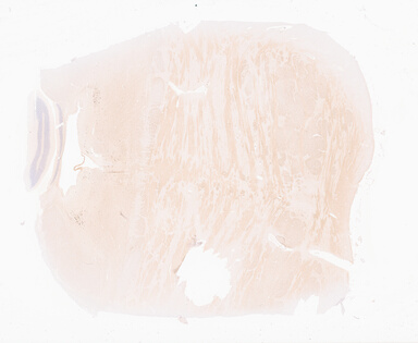 ['deident_1415abec-403a-4e2d-a0ca-babd69406bcd_69d94f0b.jpg']