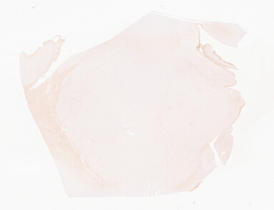 ['deident_4488b910-5676-409a-b6a4-25e7a9669a57_69d94f1a.jpg']
