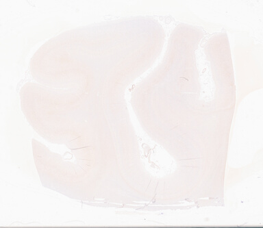 ['deident_c9034f7f-2e61-441d-a45d-9b8281be0342_69d94f6e.jpg']