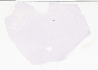 ['deident_d98bc397-77e1-4d94-9df9-d0b33d34a395_69d94f75.jpg']