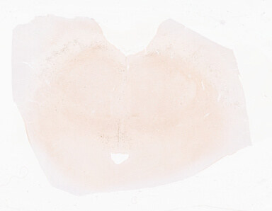['deident_80d8eba4-03db-4ed9-b02c-865254f290be_69d94f3f.jpg']