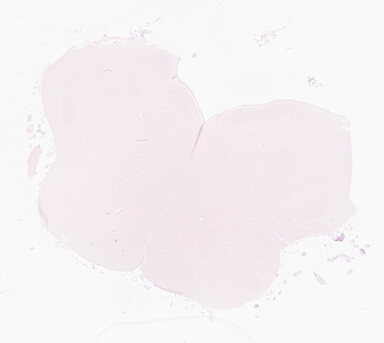 ['deident_54507000-679f-400f-8d0f-93040d9e0f92_69d94f1f.jpg']