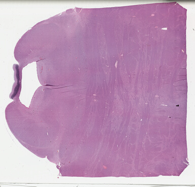 ['deident_5ffd763a-fbe1-4452-9a69-5c9168aab398_695fc29c.jpg']