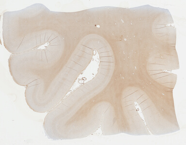 ['deident_e8189681-03bd-4fa0-ad6f-64acc91d6f5d_695fc2d4.jpg']