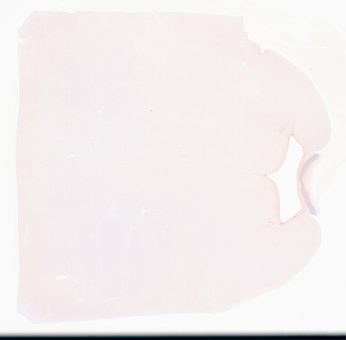 ['deident_c3948da1-080b-49f2-b53b-1723cc96e3fb_695fc2c2.jpg']