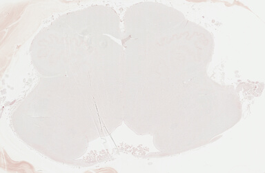 ['deident_c45a0176-8c7e-424a-991f-2d265c0eeaf8_695fc2c3.jpg']