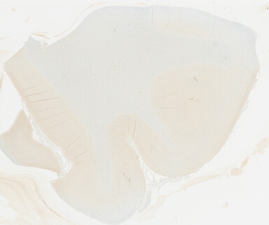 ['deident_adedfa26-8d8b-43e4-8c78-ad50171363ff_695fc2b9.jpg']